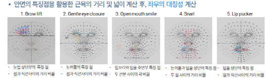 안면마비 자동진단 시스템에서 비대칭 점수 계산 및 특징 추출 방법. KIST 제공.